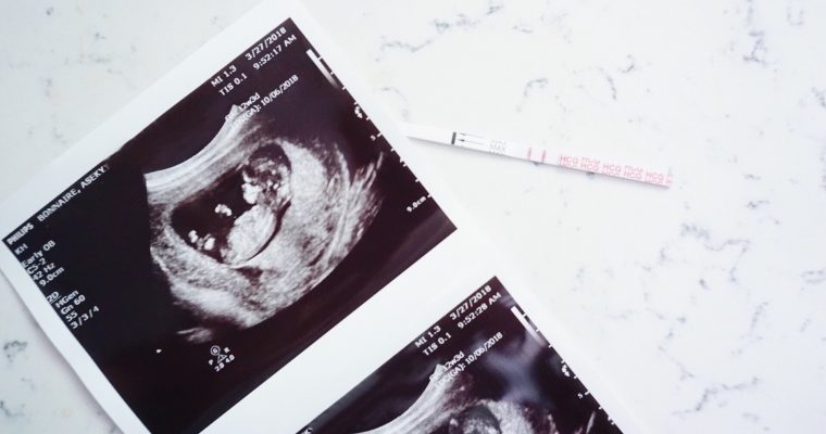 Tips for Getting Pregnant