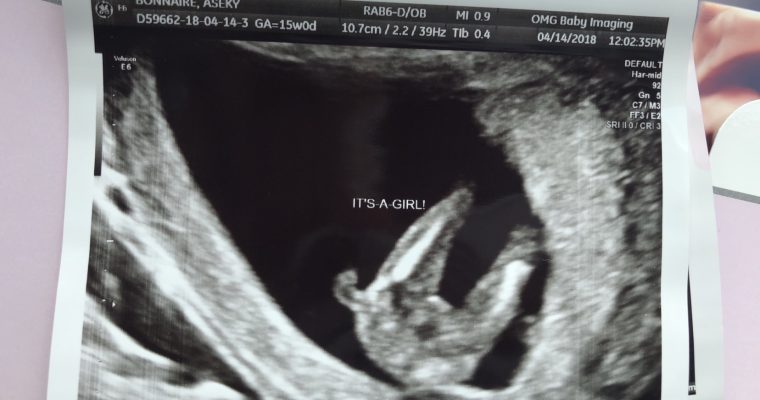 How to accurately find out the gender of your baby at 9 weeks